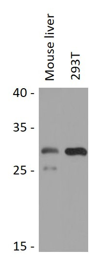 Anti-SNRPB2