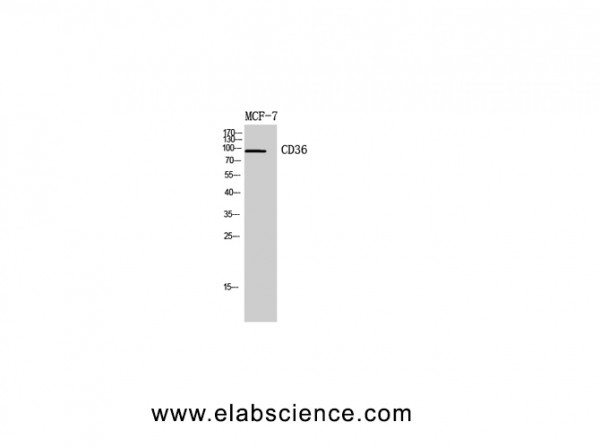 Anti-CD36