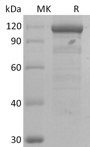 Human IL-10RB (C-Fc) Protein