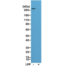 Anti-phospho-ACC (Ser79) / Acetyl CoA Carboxylase, clone RM270 (recombinant antibody)