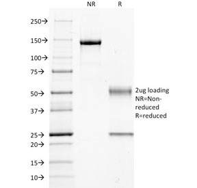 Anti-GNAQ, clone GNAQ/2434