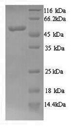 N-myc proto-oncogene protein (MYCN), human, recombinant