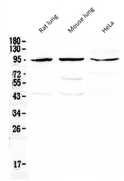 Anti-CD105 / Endoglin