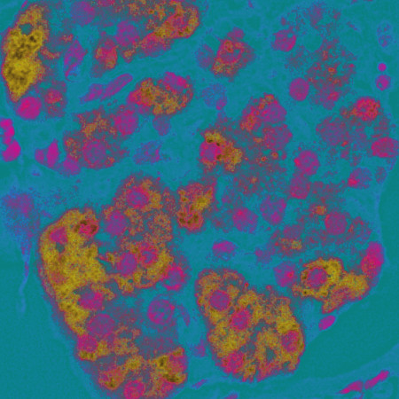 Anti-Parathyroid Hormone Receptor 1