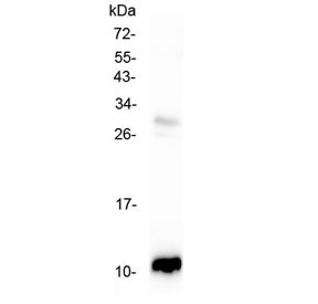 Anti-CCL2 / MCP1