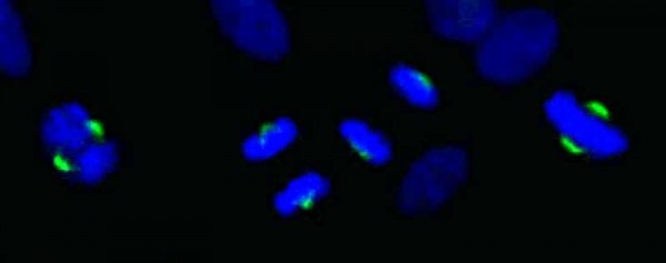 Anti-ASPM (IHC)