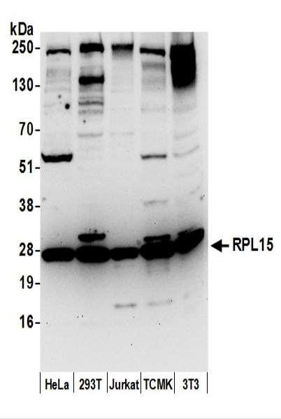Anti-RPL15/Ribosomal Protein L15