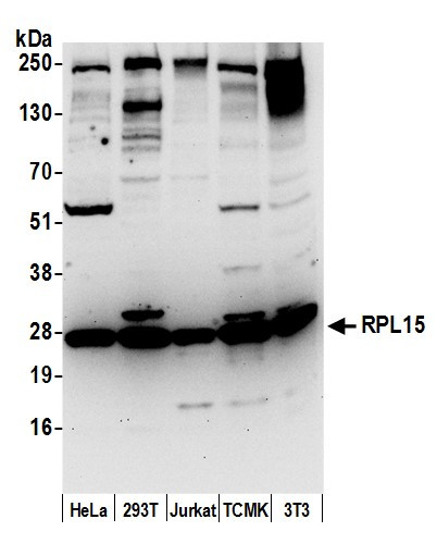 Anti-RPL15/Ribosomal Protein L15