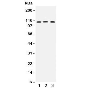 Anti-TRPC4