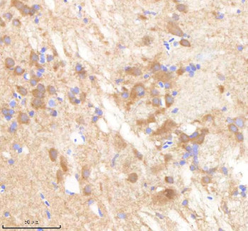 Anti-Zebrafish Pafah1b1 / Pafah1b1a / Pafah1b1b / Lissencephaly-1