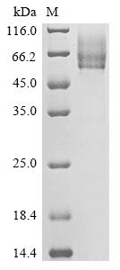 Spike glycoprotein (S), partial, human betacoronavirus 2c EMC/2012, recombinant