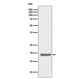 Anti-SOD1, clone AOEI-19