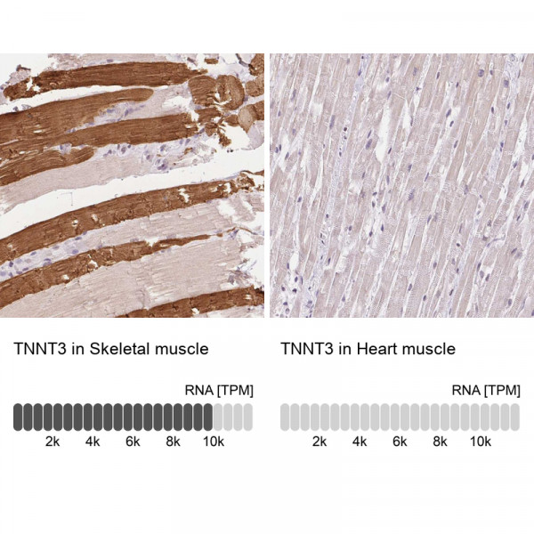 Anti-TNNT3