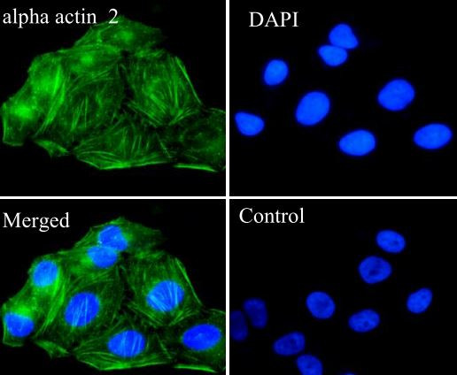 Anti-alpha smooth muscle Actin, clone SQab18108