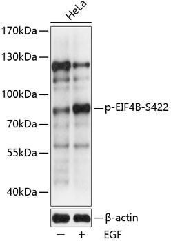 Anti-phospho-EIF4B (Ser422)