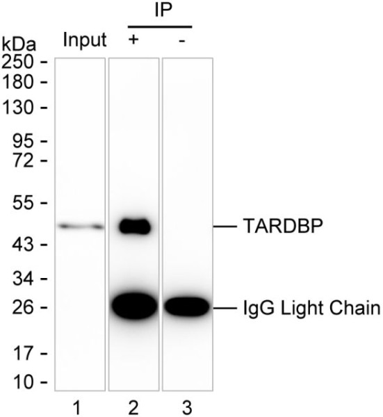 Anti-TDP-25 / TDP-35 / TDP-43