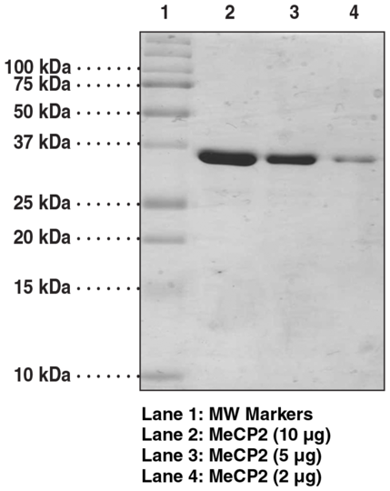 MeCP2 (human recombinant, methyl binding domain aa 77-166)