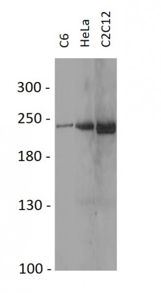 Anti-Acetyl CoA carboxylase 1