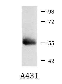 Anti-phospho-STK11 / LKB1 (Thr189)