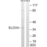 Anti-ELOVL4