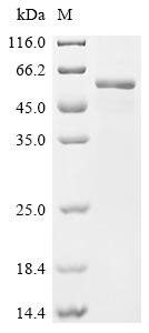 E3 ubiquitin-protein ligase RNF128 (RNF128), partial, recombinant human