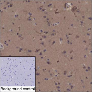 Anti-HMGCR