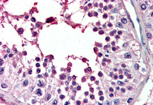 Anti-PIAS2, Internal