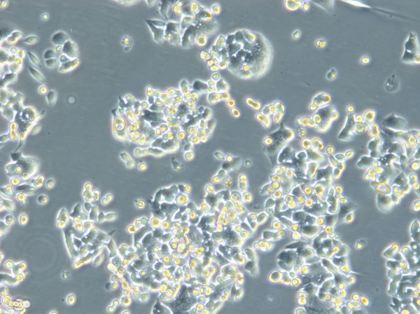 HROC257 T0 M1 Cells