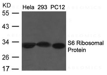 Anti-S6 Ribosomal Protein (Ab-235/236)