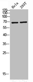 Anti-Phospho-PRKCZ (T560)