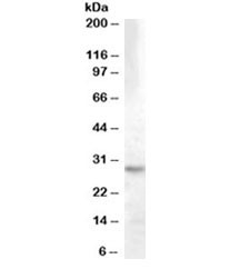 Anti-14-3-3 theta