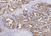 Anti-KRT7/ Cytokeratin-7 Monoclonal Antibody