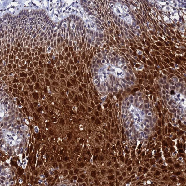 Anti-MTCL1
