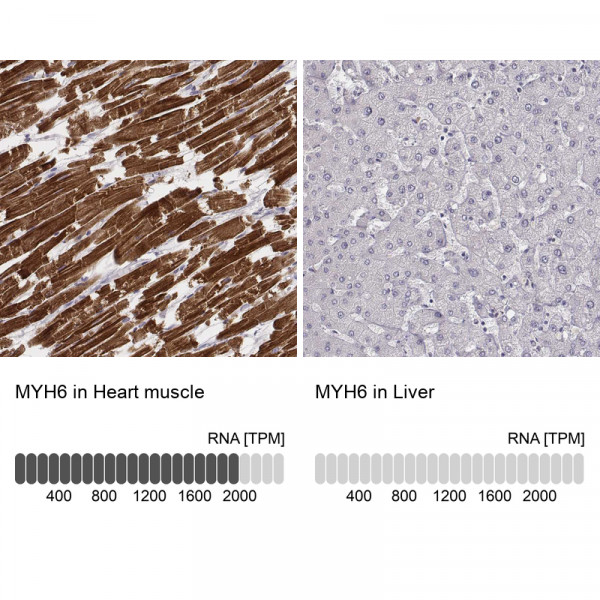 Anti-MYH6, clone CL2148