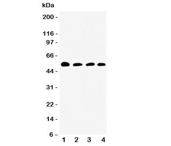 Anti-Antithrombin III