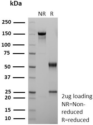 Anti-CD36 (Platelet &amp; Microvessel Marker), recombinant antibody, clone rGPIIIb/9240
