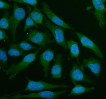 Anti-LZTS2 / Leucine zipper putative tumor suppressor 2