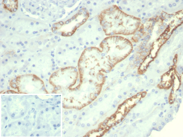 Anti-Ksp-Cadherin (Kidney-Specific Cadherin) / CDH16, recombinant antibody, clone rCDH16/7342