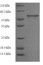 Tetanus toxin (tetX), partial, Clostridium tetani, recombinant