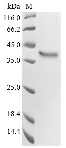 G-protein coupled receptor 62 (GPR62), human, recombinant
