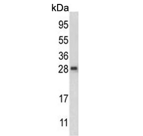 Anti-QDPR / Dihydropteridine reductase
