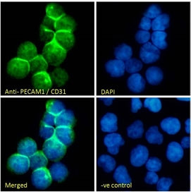 Anti-CD31 / PECAM-1