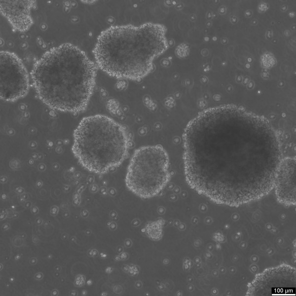 B-LCL-HROC69 Cells