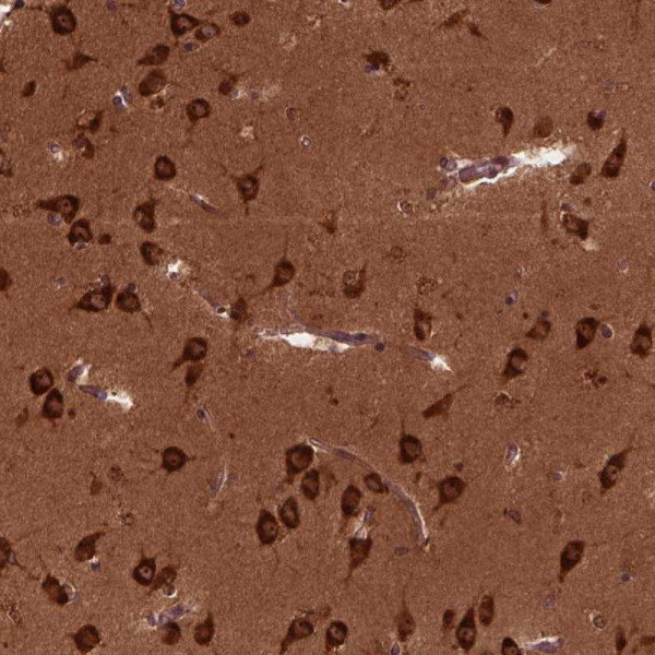 Anti-CYFIP1