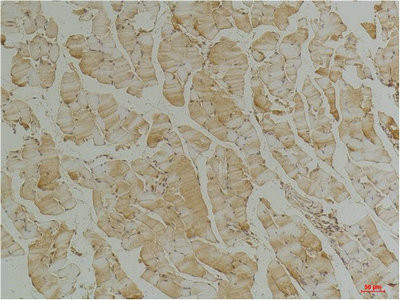 Anti-DES Monoclonal