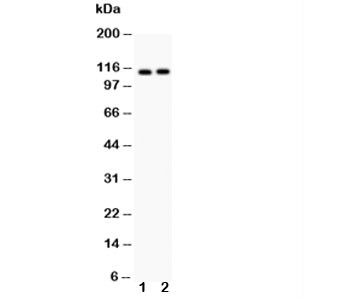 Anti-ATP2A2