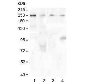 Anti-TRPM7