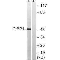 Anti-CTBP1 (Ab-422)