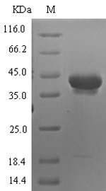 Neurotrypsin (PRSS12), partial, human, recombinant