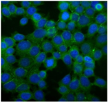 Anti-Desmoglein 2